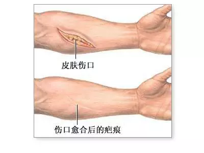 海口祛疤痕哪个医院好