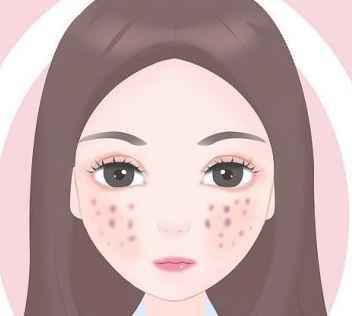 海口看痘坑哪里比较好